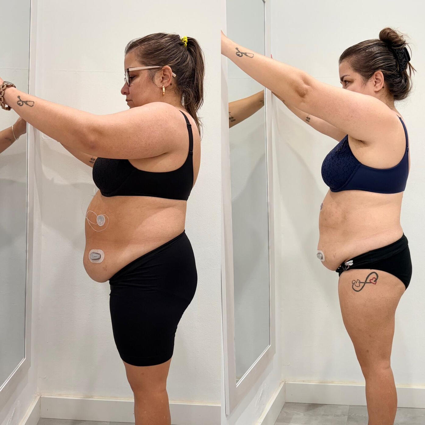 Layda - "Padezco diabetes tipo II, y desde que fui madre me había abandonado. Lara ha cambiado mi vida. Gracias a su método, en solo 4 meses he perdido 10 kilos y he bajado más de 40 cm de contorno en la tripa."
