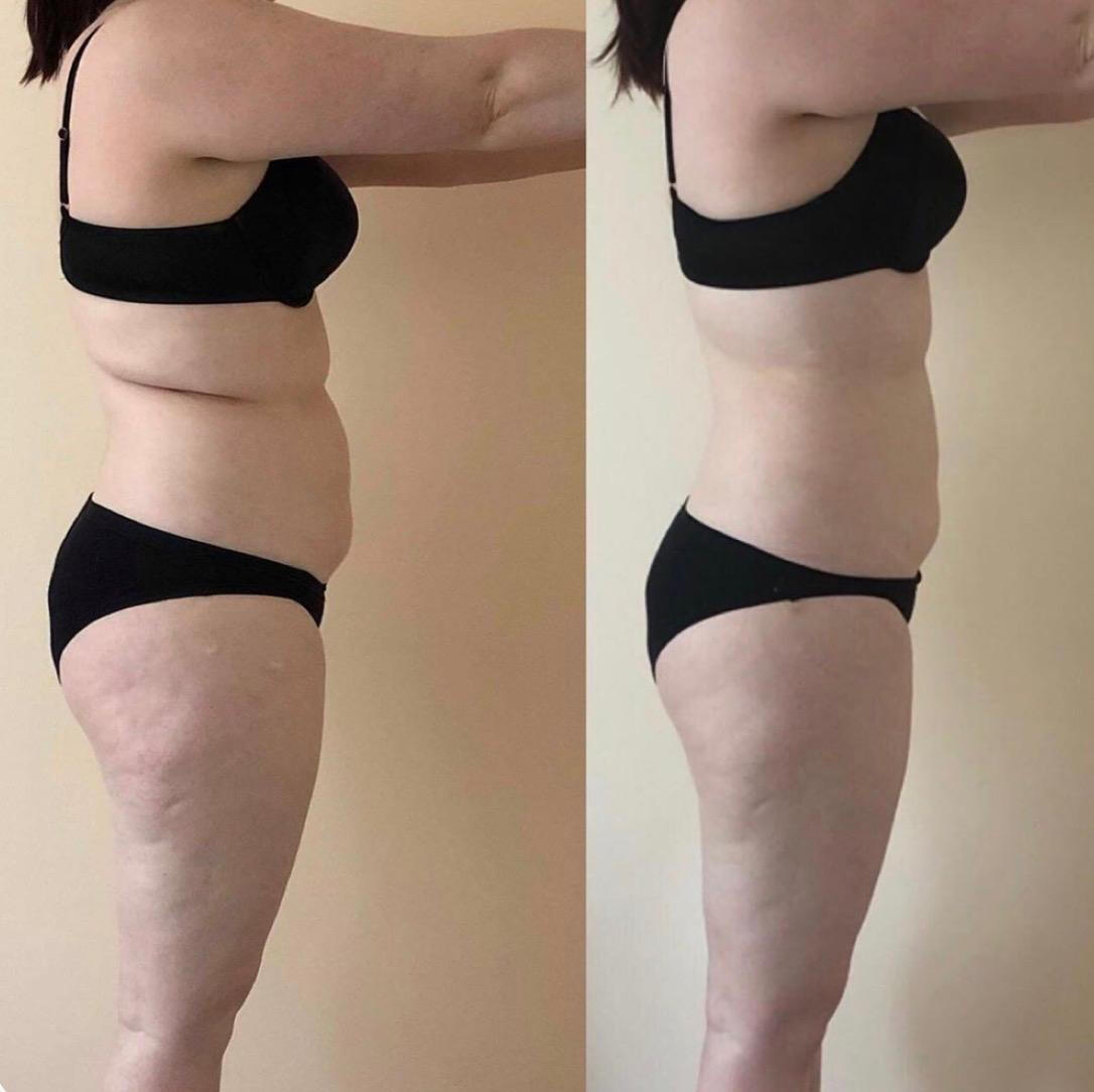 María - "Tengo 42 años y he cambiado mi cuerpo gracias al Método Mónaco. Esta foto es después de un mes con mi plan de buenos hábitos. La grasa de mi cuerpo ha desaparecido!!!! Ahora ya no sufro de dolores ni de cansancio crónico."